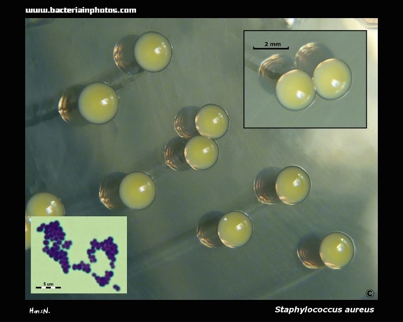 Staph aureus